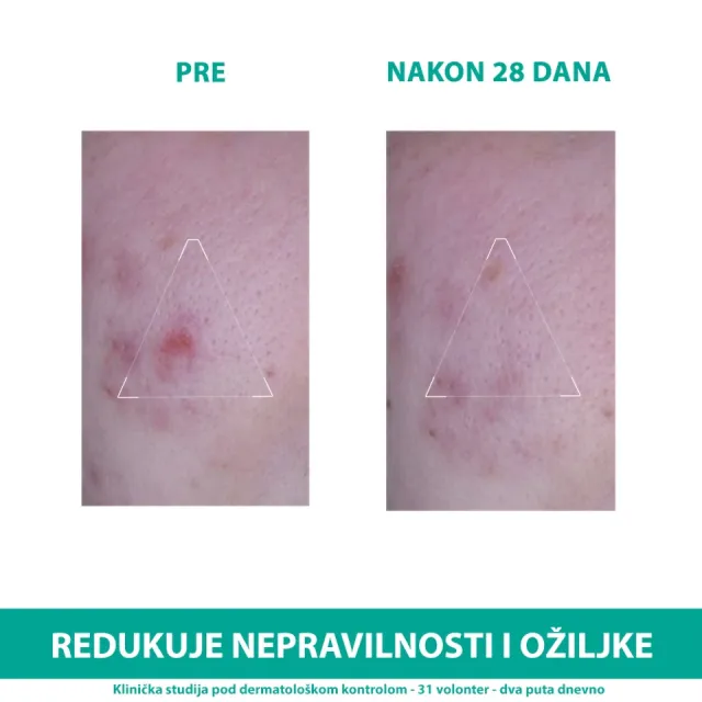 Uriage Hyseac 3-Regul+ Krema, 40Ml