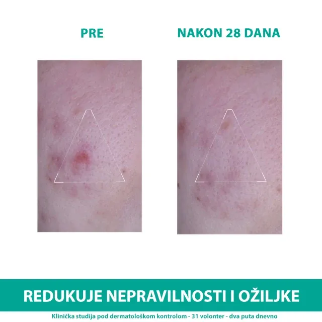 Uriage Hyseac 3-Regul+ Krema 40 Ml