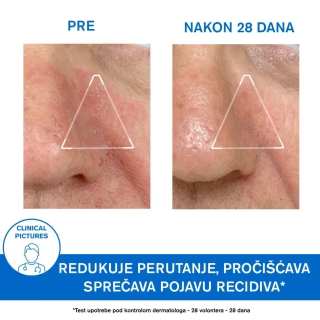 Uriage Ds Emulzija 40 Ml