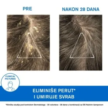 Uriage DS Keratoregulatorni Šampon 150 ml